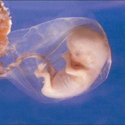 web_8 wk preborn baby